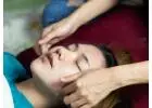 Facial Acupuncture NYC